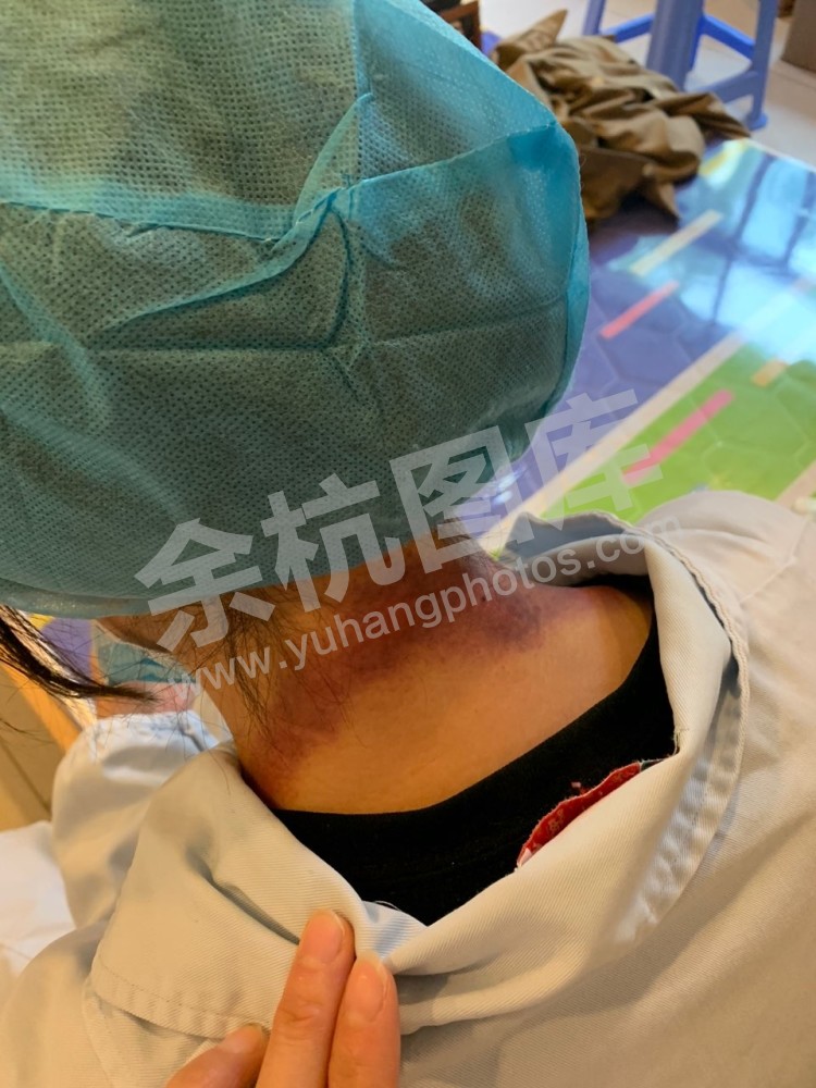 五常接种点